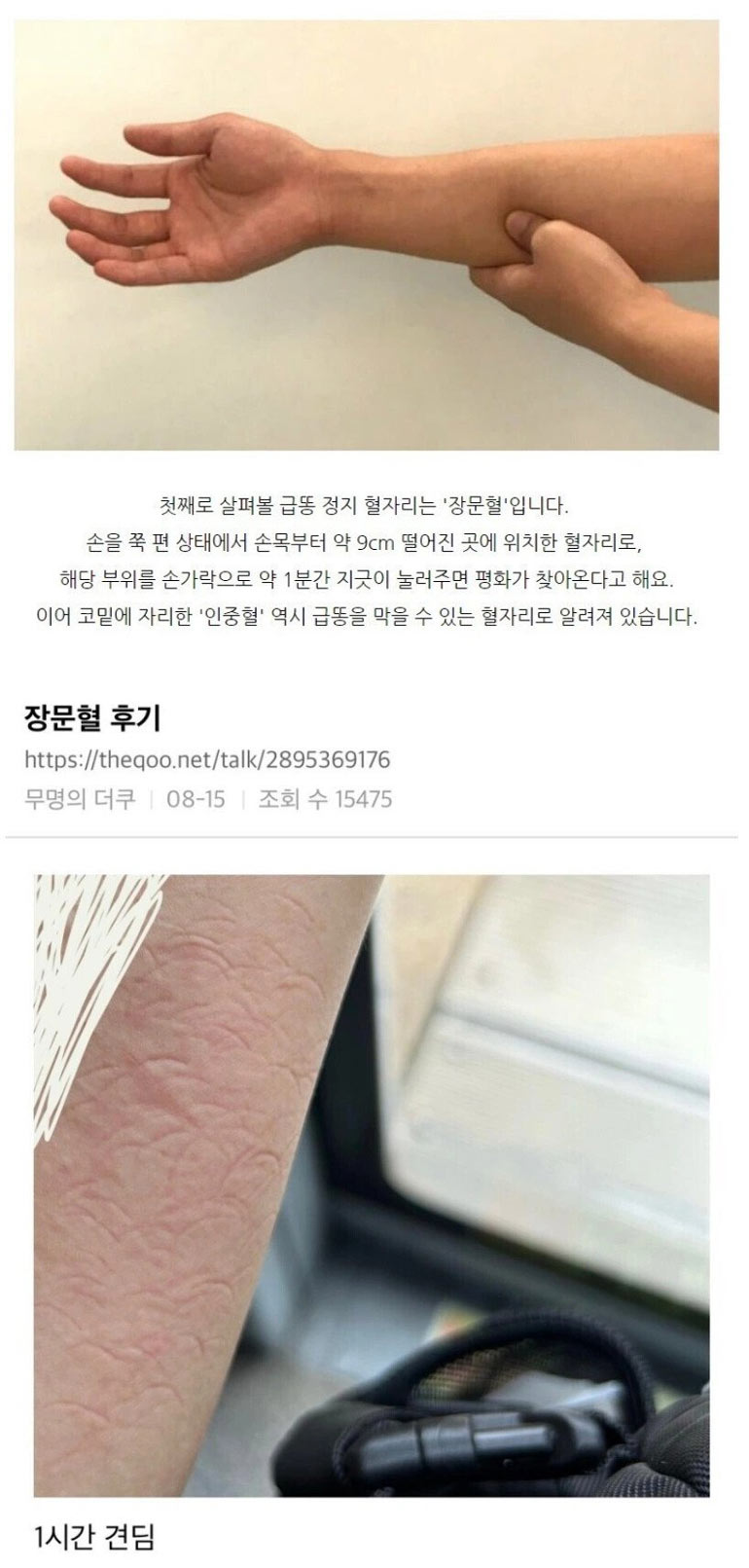 장문혈 후기