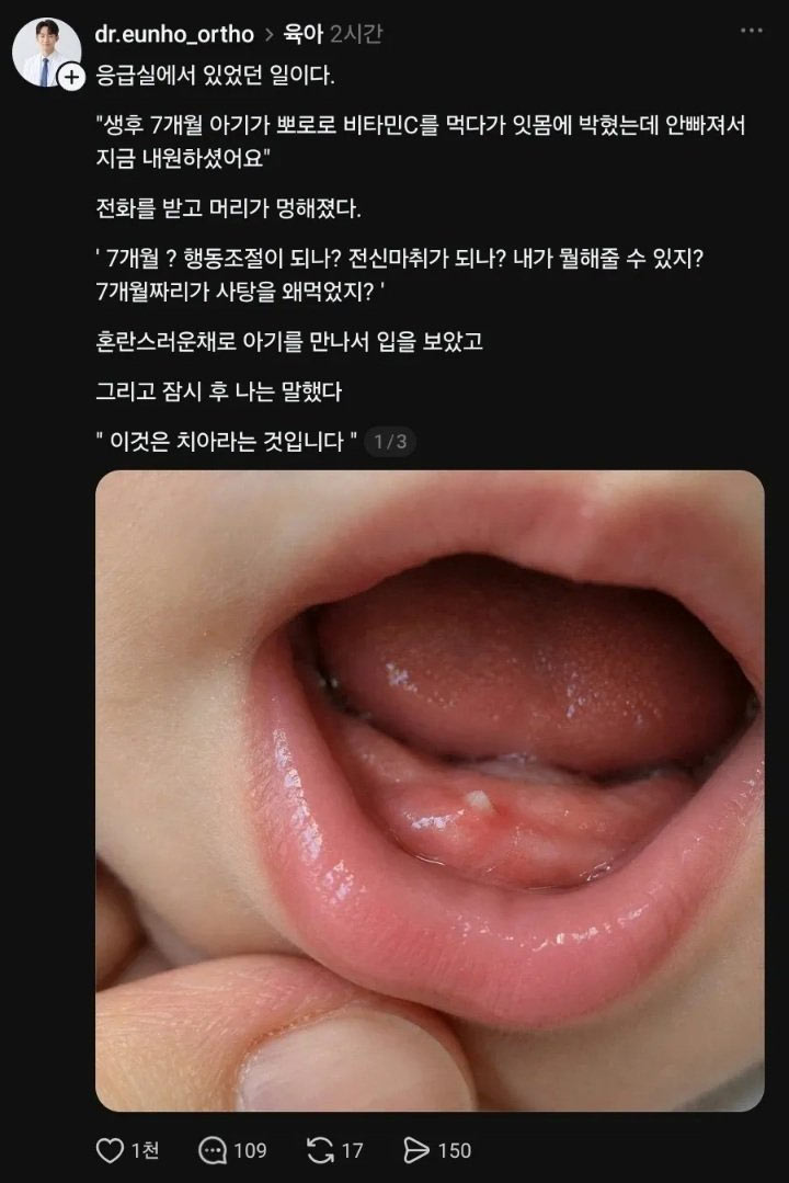 아기 잇몸에 뽀로로 비타민이 박혀서;
